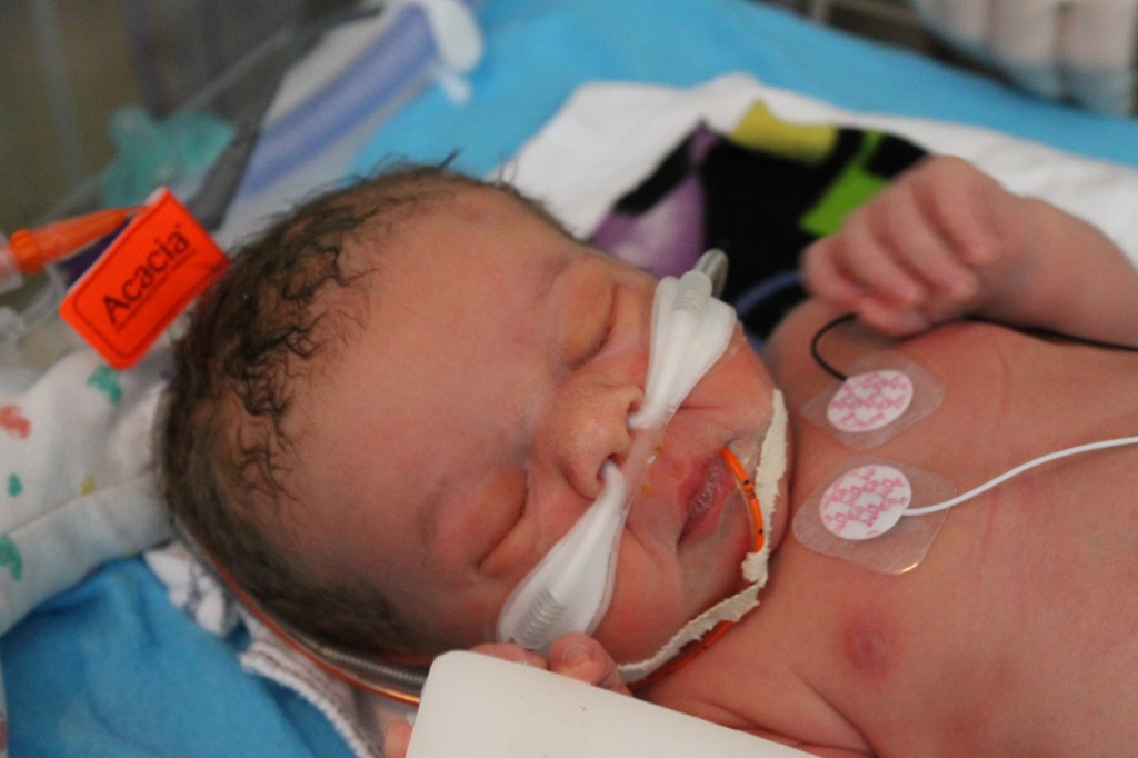 Nathan Reagan - In the NICU and Improving